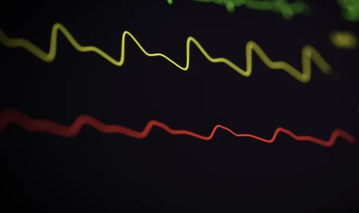 pulse